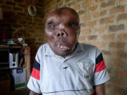 Tin tức - Người đàn ông xấu nhất thế giới lấy vợ lần 3, nhìn sang cô dâu ai cũng ngỡ ngàng