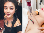 Làm đẹp - Sự thật công nghệ xóa xăm không sẹo có hiệu quả như quảng cáo