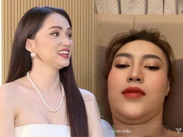 Không phải cứ tăng cân mới có nọng, hội mỹ nhân gầy gò mà vẫn có lúc "hai cằm"