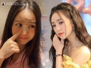 Làm đẹp - Quỳnh Kool lộ video PTTM nâng mũi, nhưng cách giải thích sau đó khiến dân tình ngã ngửa