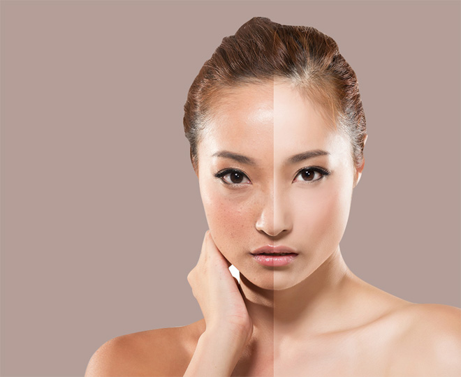 Thiệt hại “không phanh” vì trắng da cấp tốc! - 2