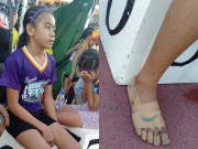 Tin tức - Bé gái Philippines quấn băng vào chân giả làm giày hiệu vẫn đoạt 3 huy chương vàng giờ ra sao?