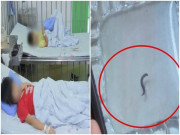 Sức khỏe - Hai chị em đều bị đau khi đi vệ sinh, BS bất ngờ phát hiện thứ này trong nước tiểu