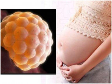 Từ vụ cô gái 20 tuổi chửa trứng: Những dấu hiệu cần lưu ý để phát hiện sớm điều này