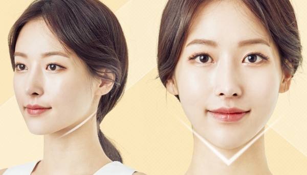 Muốn tiêm filler làm đẹp, nàng nên nắm những lưu ý sau để tránh tiền mất tật mang - 8