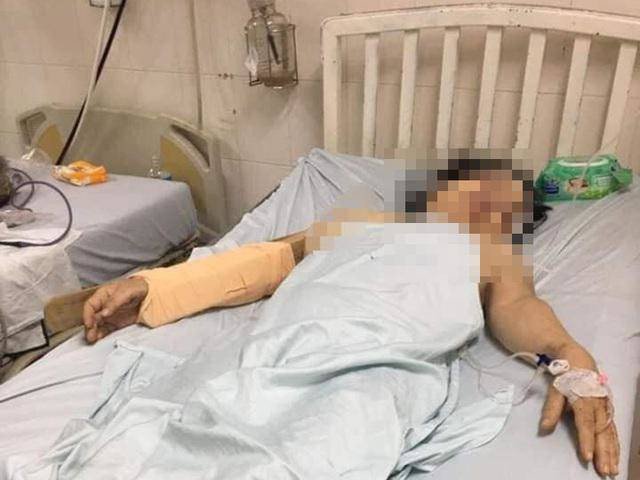 Vụ người đàn ông dùng gậy dài 1m đánh vợ cũ dã man: Bất ngờ chia sẻ của hàng xóm