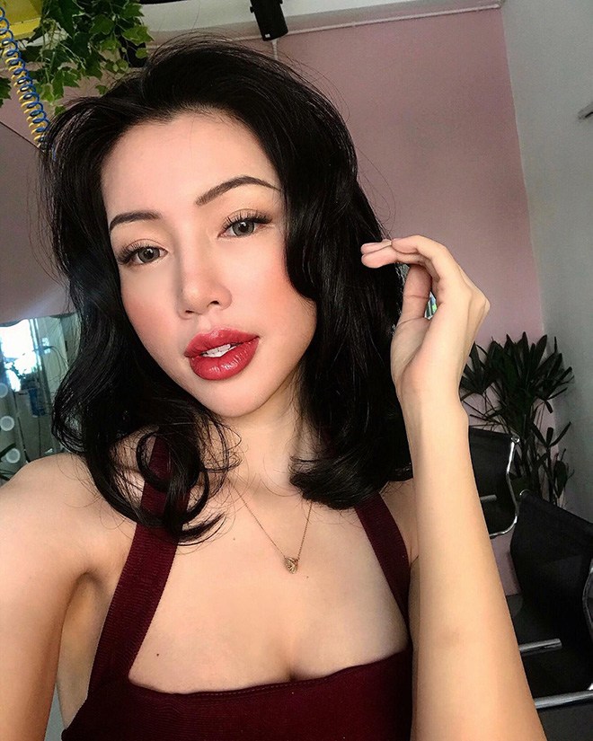Đu mốt bơm môi gợi cảm: vợ Ưng Hoàng Phúc bị chồng la, có cô dày cộm cứng đờ - 10