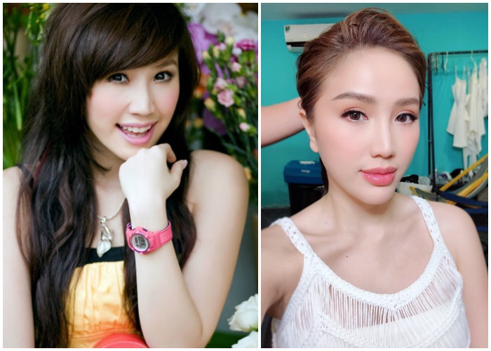Đu mốt bơm môi gợi cảm: vợ Ưng Hoàng Phúc bị chồng la, có cô dày cộm cứng đờ - 4