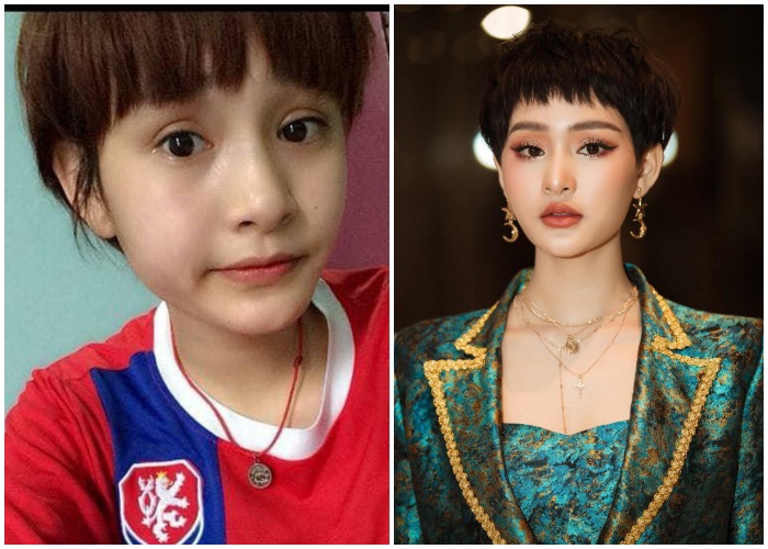 Đu mốt bơm môi gợi cảm: vợ Ưng Hoàng Phúc bị chồng la, có cô dày cộm cứng đờ - 3