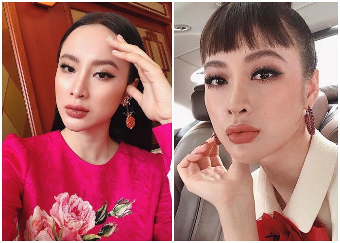 Đu mốt bơm môi gợi cảm: vợ Ưng Hoàng Phúc bị chồng la, có cô dày cộm cứng đờ - 8