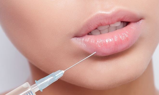 Đu mốt bơm môi gợi cảm: vợ Ưng Hoàng Phúc bị chồng la, có cô dày cộm cứng đờ - 11
