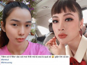 Đu mốt bơm môi gợi cảm: vợ Ưng Hoàng Phúc bị chồng la, có cô dày cộm cứng đờ