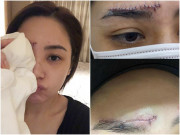 Giải trí - Ngôi sao 24/7: Bị tai nạn, mỹ nhân Cbiz khâu 60 mũi trên mặt, vết sẹo dài trông đáng sợ