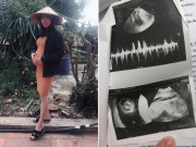 Bà bầu - Bác sĩ liên tục bắt bỏ vì thai dị tật, mẹ 9X bướng bỉnh giữ đến cùng và cái kết