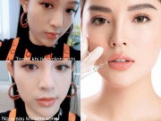 Làm đẹp - Những bộ phận có thể làm đẹp bằng filler giúp chị em "lên đời" nhan sắc
