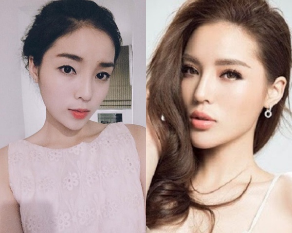 Những bộ phận có thể làm đẹp bằng filler giúp chị em amp;#34;lên đờiamp;#34; nhan sắc - 5