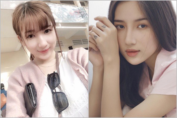 Những bộ phận có thể làm đẹp bằng filler giúp chị em amp;#34;lên đờiamp;#34; nhan sắc - 6