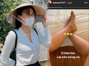 Sao Việt cháy nắng sau mùa hè: loạt Hoa hậu da hai màu, Thuỷ Tiên kêu trời vì hậu quả