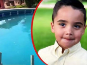 Sức khỏe - Mỹ: Xuất hiện ca tử vong đầu tiên sau khi phát hiện amip ăn não trong nguồn nước sinh hoạt