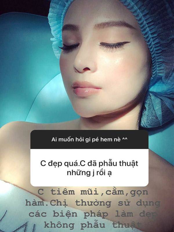 Khi được hỏi bản thân đã phẫu thuật những bộ phần nào rồi, Huyền Baby cho biết cô chỉ sử dụng phương pháp làm đẹp không phẫu thuật. Tiêm filler những bộ phận như cằm, môi, mũi hay má để duy trì vẻ trẻ trung xinh đẹp.