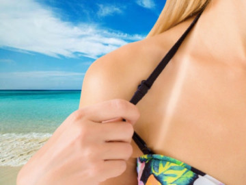 Cứu cánh làn da tối màu nhanh chóng với 8 bí quyết chữa sạm nắng siêu đơn giản tại nhà