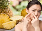 Da sáng, láng mịn với những bí quyết trị mụn cơm siêu đơn giản nhưng vô cùng hiệu quả