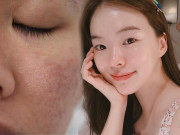 Làm đẹp - Bạn đang làm những việc khiến lỗ chân lông nở "toang hoác" mỗi ngày, dừng ngay còn kịp