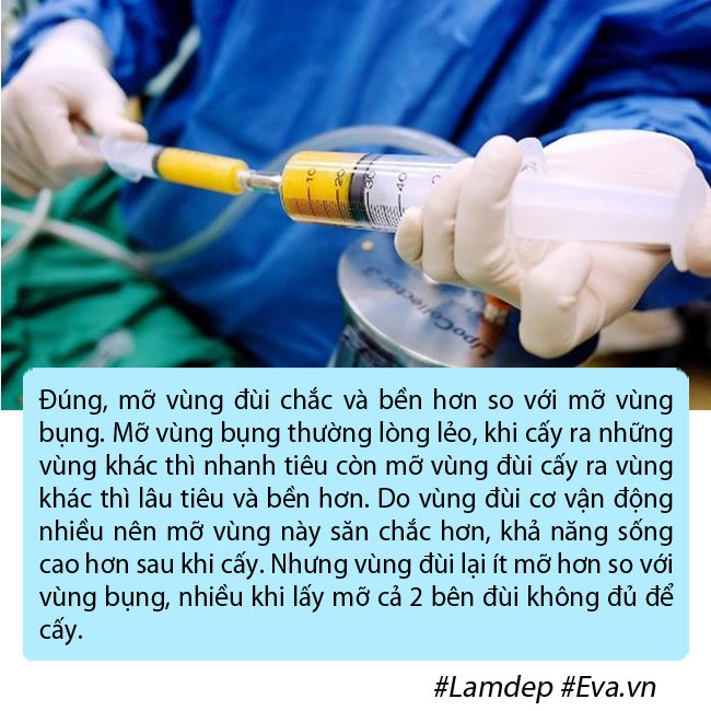 amp;#34;Bom sexamp;#34; Anh phải nằm ngửa, treo 2 chân lên cao trong nhiều ngày vì phù nề sau hút mỡ - 8