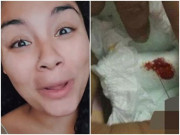 Làm mẹ - Mẹ bỉm sữa lo lắng khi con 3 tuần tuổi đã “rụng dâu", đỏ hết cả bỉm