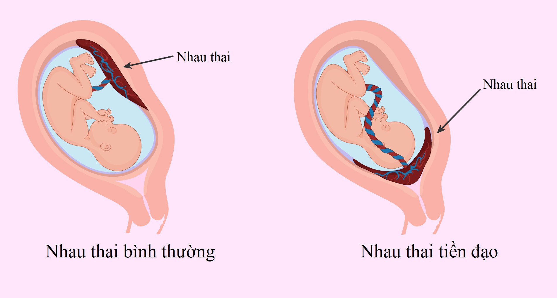 Sản phụ ôm amp;#34;quả bom nổ chậmamp;#34; vào nhập viện khiến bác sĩ toát mồ hôi hột - 3