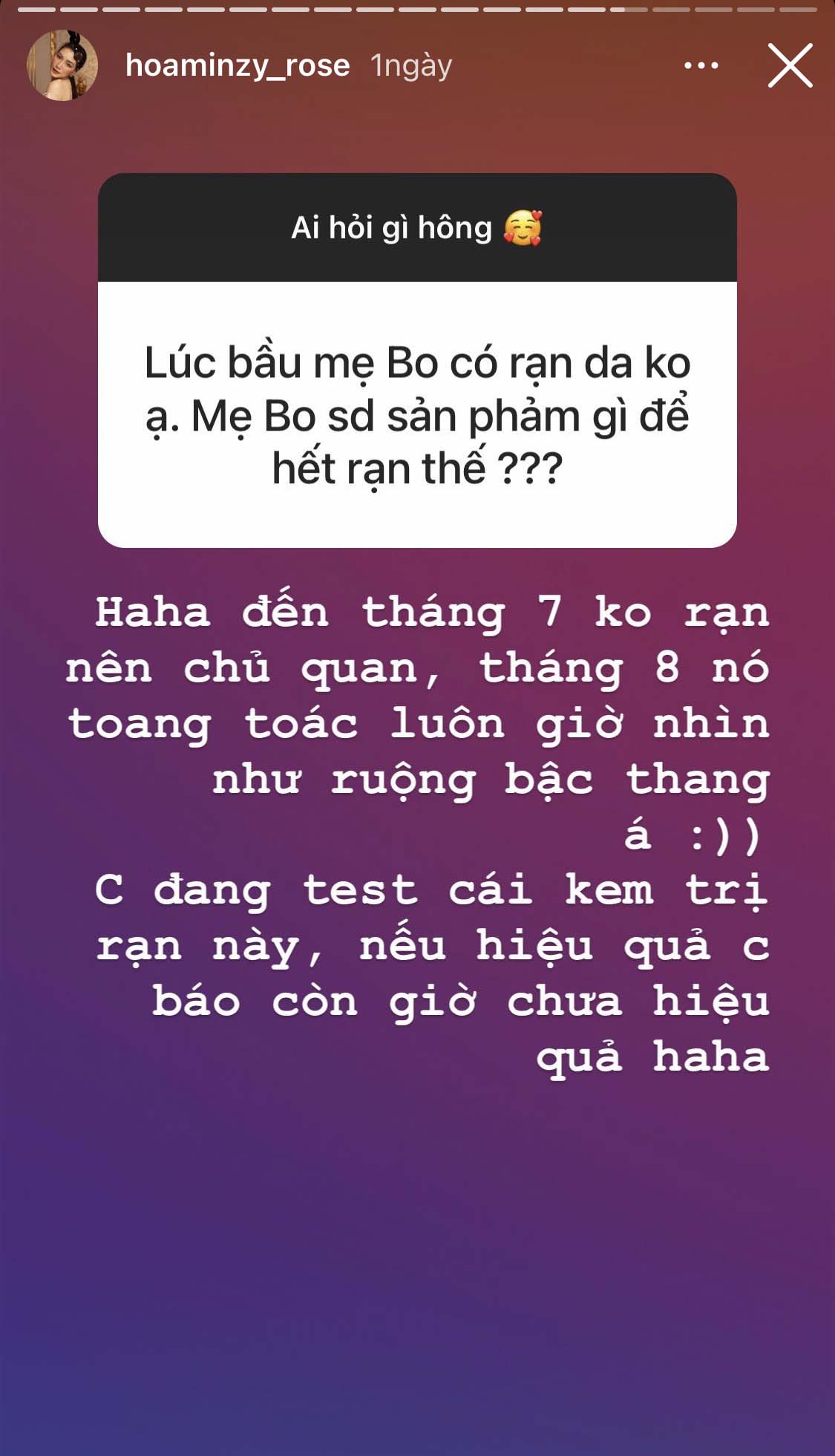 Hoà Minzy amp;#34;bócamp;#34; khuyết điểm sau sinh: Có bộ phận như ruộng bậc thang, vẫn đang tìm cách chữa - 5