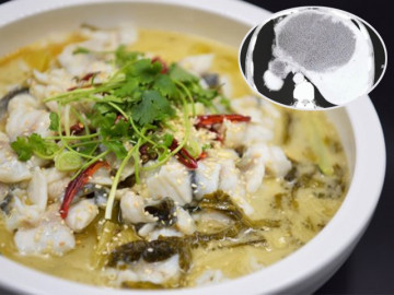 Gan rỗng tuếch chứa đầy trứng sán vì kiểu ăn cá cực tai hại nhưng không ít người mê