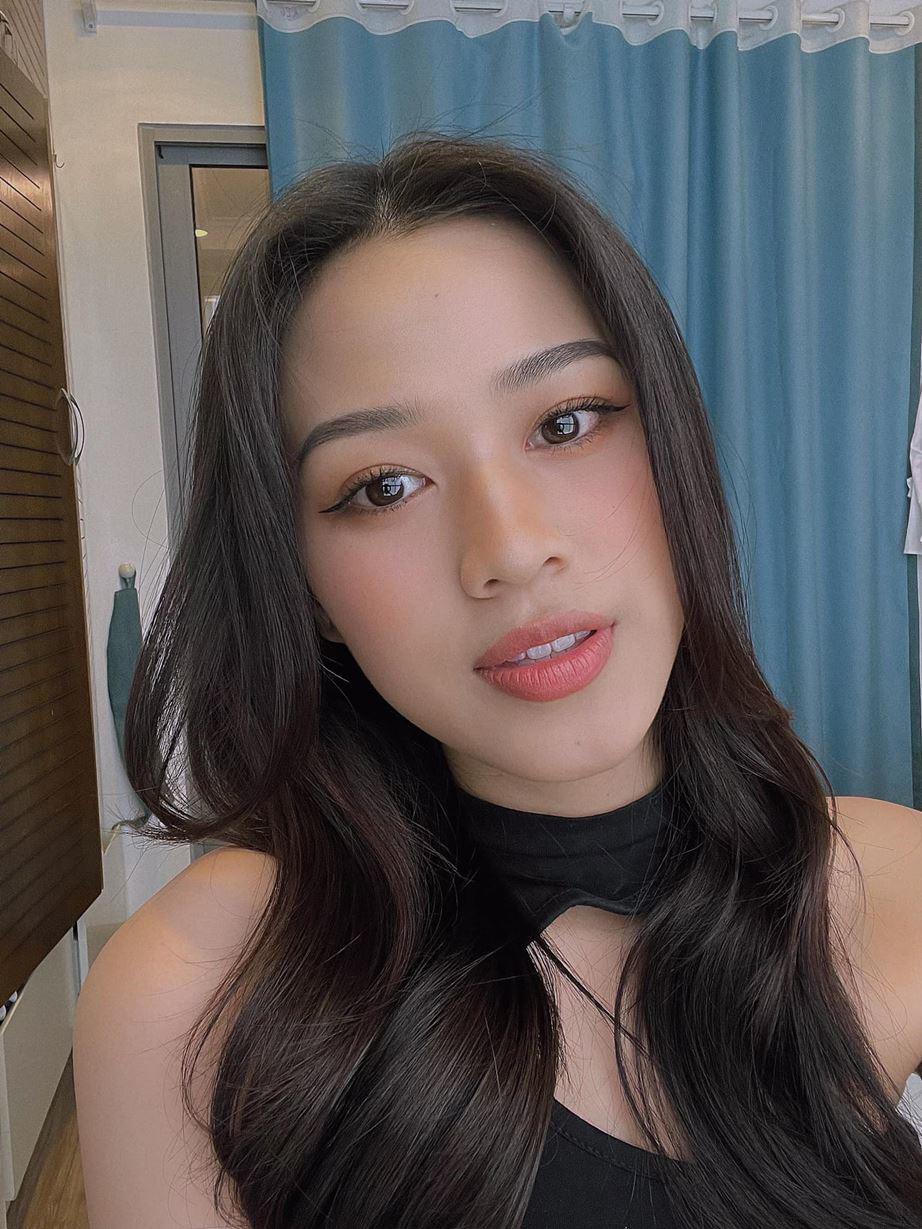 Chân dài chọn phương pháp niềng răng trong suốt, tuy không gây hiệu ứng hàm răng sắt như xưa kia nhưng có thể thấy khuôn miệng của cô vẫn có chút không được tự nhiên vì phải đeo khay.