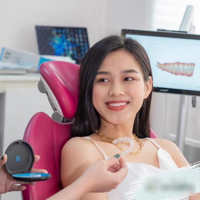 Mới đây, cô nàng đã công khai công đoạn tu sửa nhan sắc của mình với việc đi chỉnh nha, niềng răng. Hầu hết các người đẹp Vbiz đều rất quan trọng hàm răng. Người chọn cách làm răng sứ, người chọn biện pháp thủ công hơn là niềng răng.