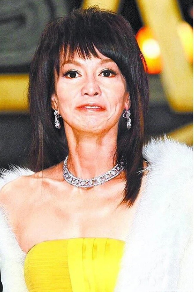 Trịnh Du Linh bị nghi thẩm mỹ để níu kéo tuổi thanh xuân.