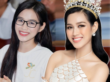 Đỗ Thị Hà công khai tu sửa hàm răng nhưng nhất định chối 1 bộ phận khác