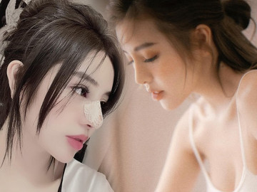 Nâng mũi như cuộc chạy đua với thời trang, làm đủ kiểu cuối cùng vẫn quay về 1 dáng