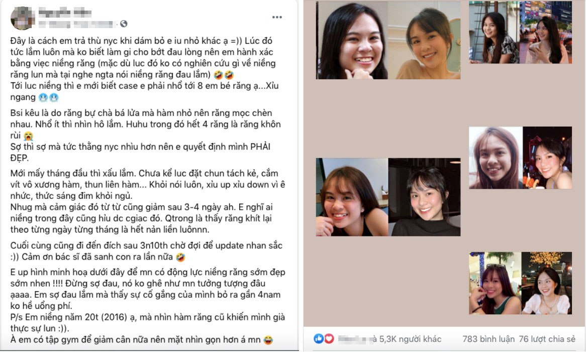 Bài đăng của cô nàng có màn dằn mặt người yêu cũ đỉnh chóp trong 1 group làm đẹp đã thu về hơn 5.300 lượt reaction, 783 bình luận cùng 76 chia sẻ chỉ trong thời gian ngắn đăng tải.