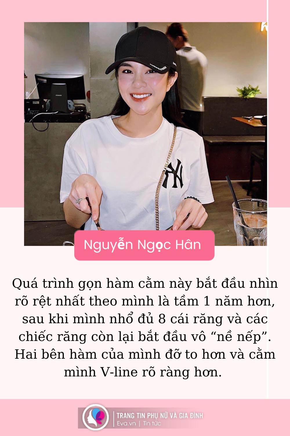 Cô gái amp;#34;dằn mặtamp;#34; người yêu cũ khi gỡ bỏ 8 chiếc răng, từ vịt hoá thiên nga - 7