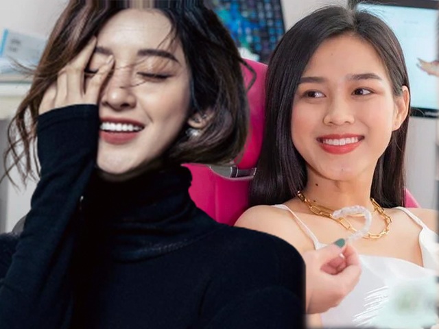 Thẩm mỹ nụ cười được nhiều Hoa hậu ứng dụng như thế nào