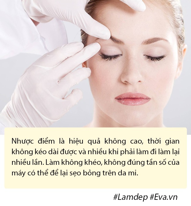 Ảnh xưa và nay đổi khác, Hiền Hồ chối cắt mí nhưng vẫn thừa nhận có làm mí mắt! - 12