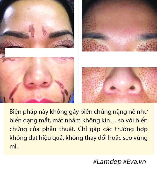 Ảnh xưa và nay đổi khác, Hiền Hồ chối cắt mí nhưng vẫn thừa nhận có làm mí mắt! - 13