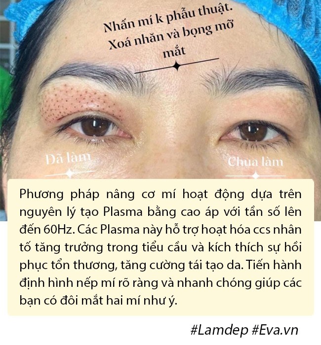 Ảnh xưa và nay đổi khác, Hiền Hồ chối cắt mí nhưng vẫn thừa nhận có làm mí mắt! - 10