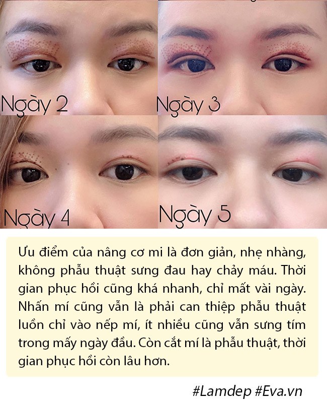Ảnh xưa và nay đổi khác, Hiền Hồ chối cắt mí nhưng vẫn thừa nhận có làm mí mắt! - 11