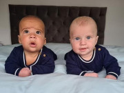 Tin tức - Người mẹ sốc nặng khi thấy ngoại hình của 2 con song sinh, tỷ lệ triệu ca có một