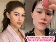 Làm đẹp - Ái nữ đại gia Ngọc Thanh Tâm tự mua kim nặn mụn, làn da nhận cái kết "đắng"