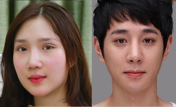 Cắt mí mắt nam và nữ có sự khác biệt để phù hợp hơn với mỗi người.