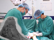 Sức khỏe - Bé gái nguy kịch sau khi đau mắt cá chân, BS cảnh báo dấu hiệu tuyệt đối không chủ quan 