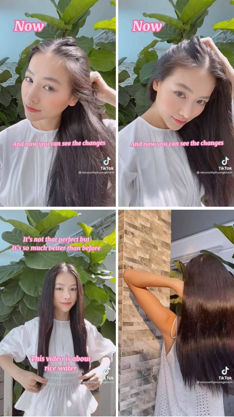 Rẻ-Đẹp-Dễ: Hoa hậu Phương Khánh tóc rụng cả mảng, nhìn công đoạn chữa hói mới không ai ngờ - 6