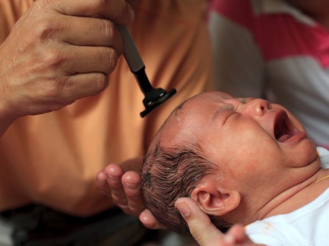 90% mẹ Việt sẽ dừng ngay việc cạo trọc đầu con cho mát vào mùa hè vì nguy hiểm này - 1